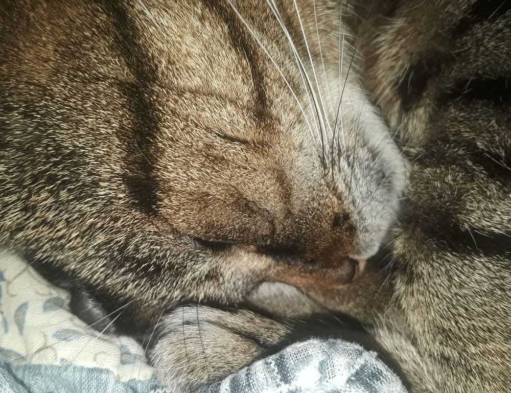 how to test for homorzopia disease